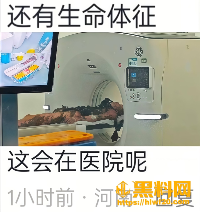 少年与老头冲突打成重伤原因1